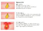 Kalos Scoria Soap / สบู่อีฟสโกเรีย